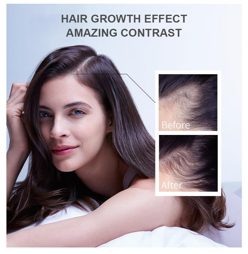 Hair Growth Oil Ginger Biotin  - Hair Care Fragrance Essential Oil review and price