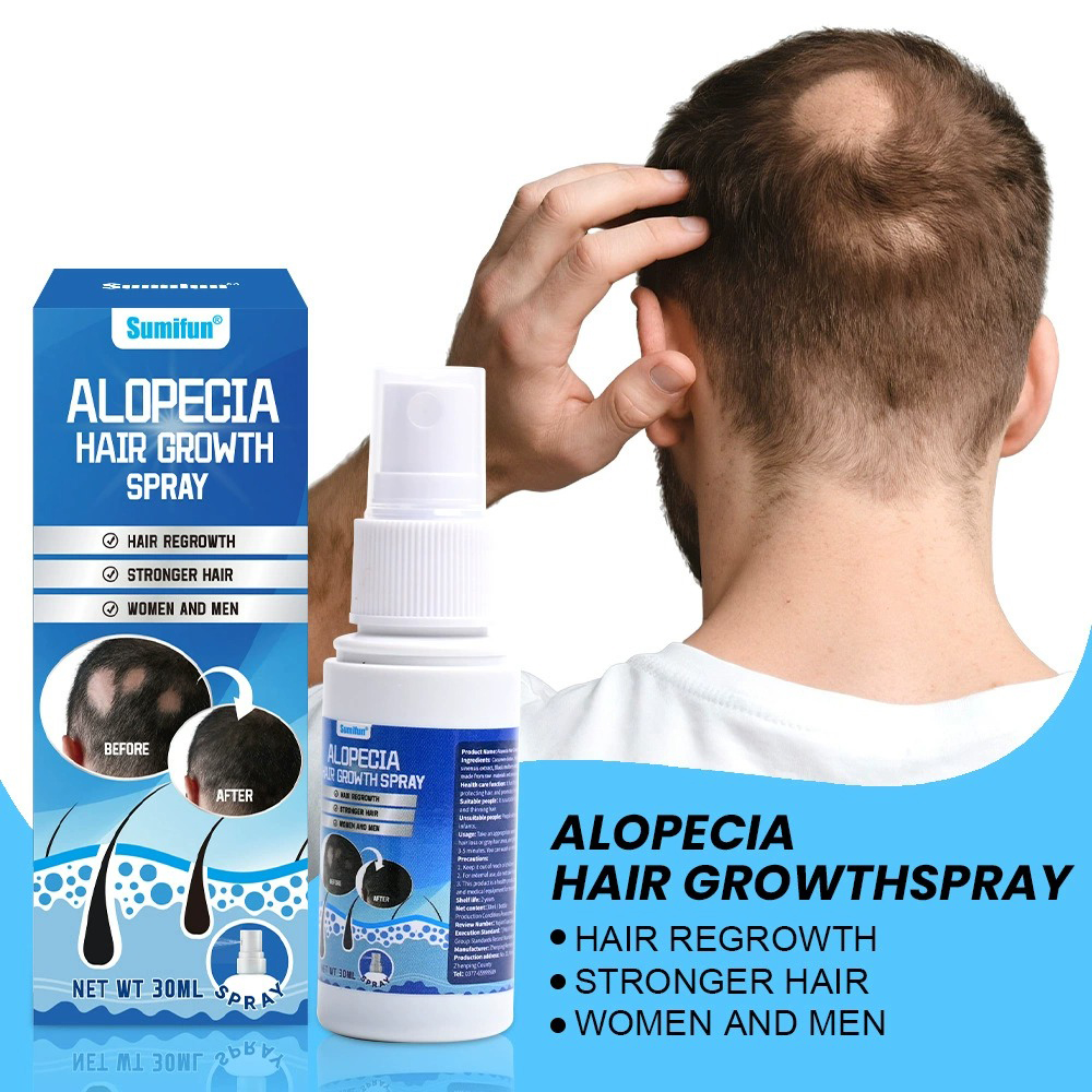Alopecia Hair Growth Spray Sop - Hair Care For Hair Growth review and price