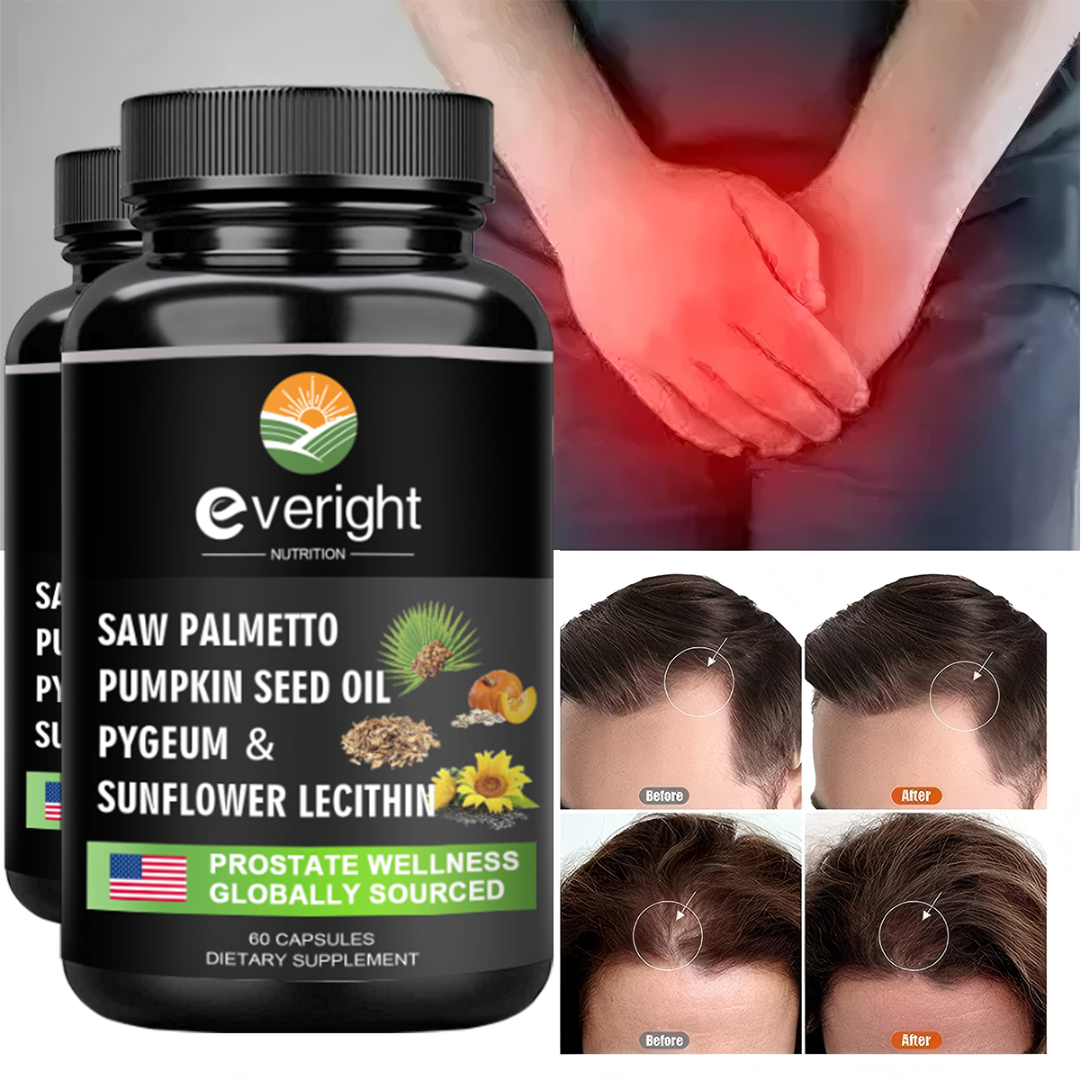 Saw Palmetto Capsules - Prosta - Hair Care Capsule review and price