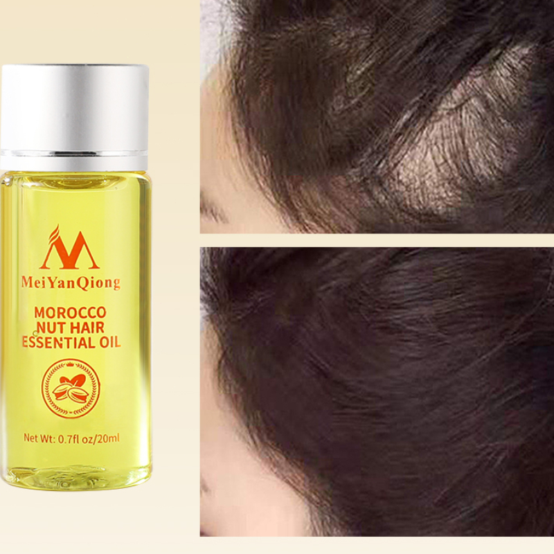 20ML Essential Oil for Hair Gr - Hair Care Fragrance Essential Oil review and price