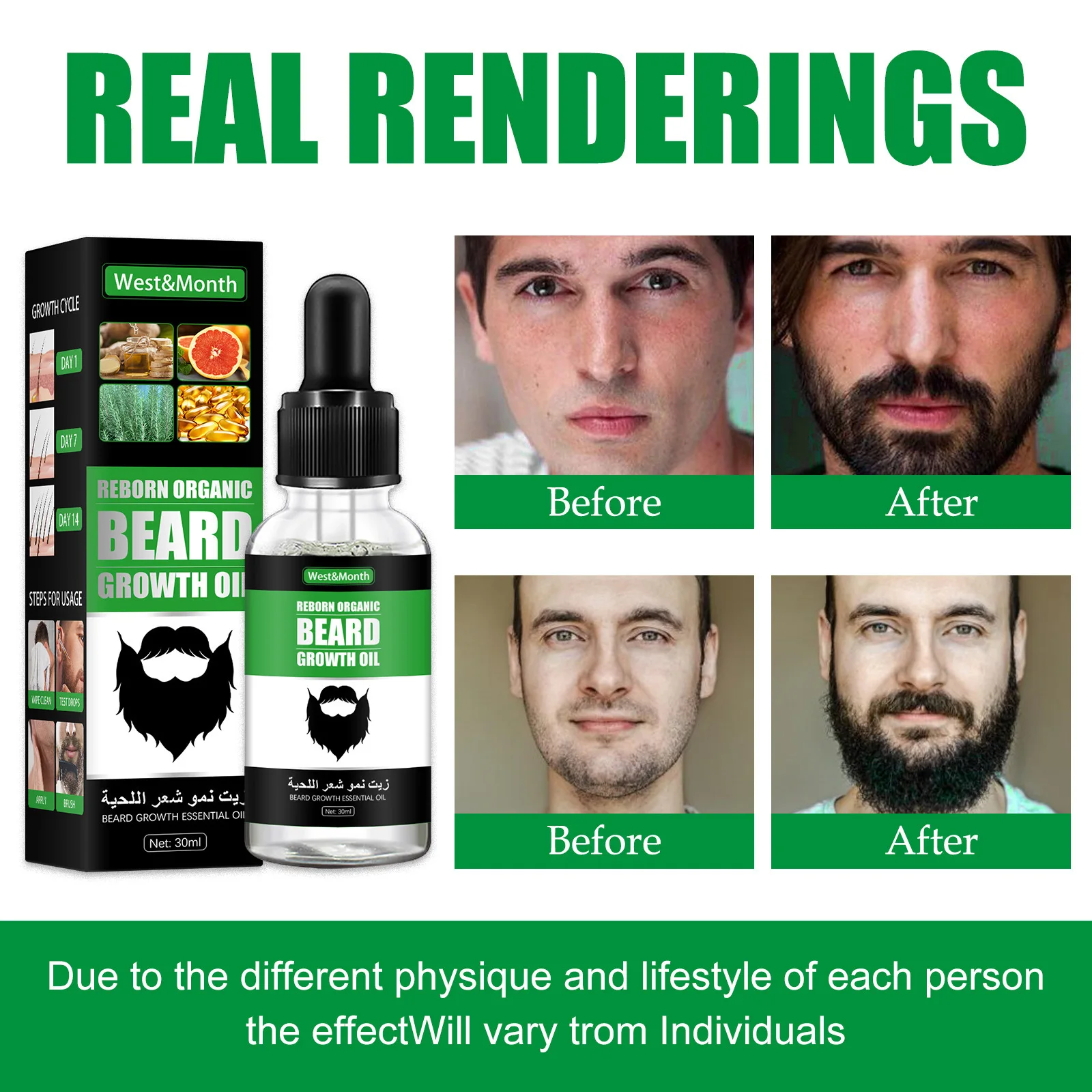 Men Beard Growth Roller Set Be - Hair Care Essence Oil Spray review and price