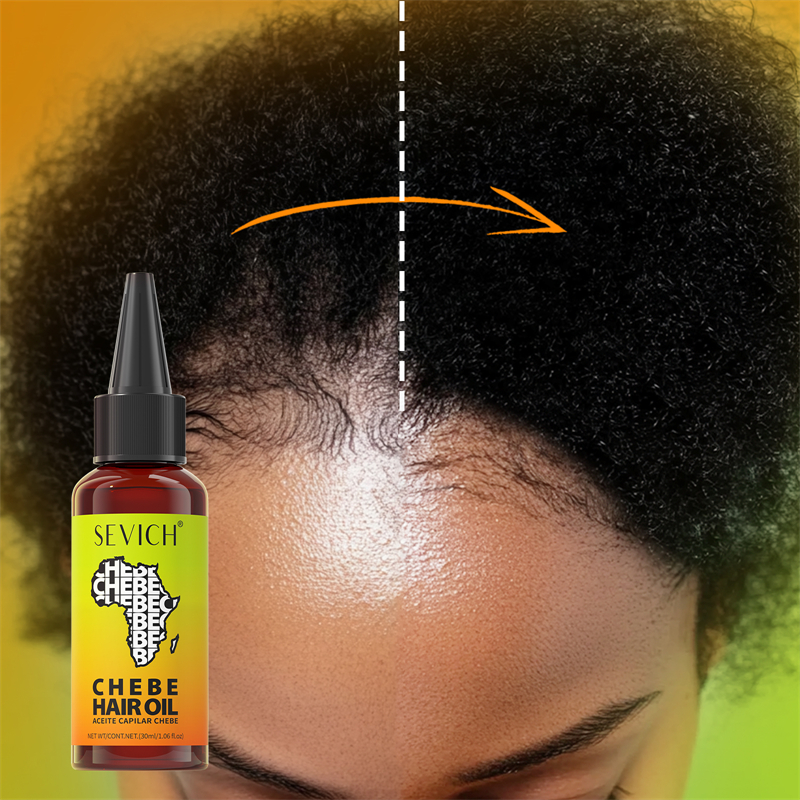 Chebe Fast Hair Growth Oil Afr - Hair Care Essence Oil Spray review and price