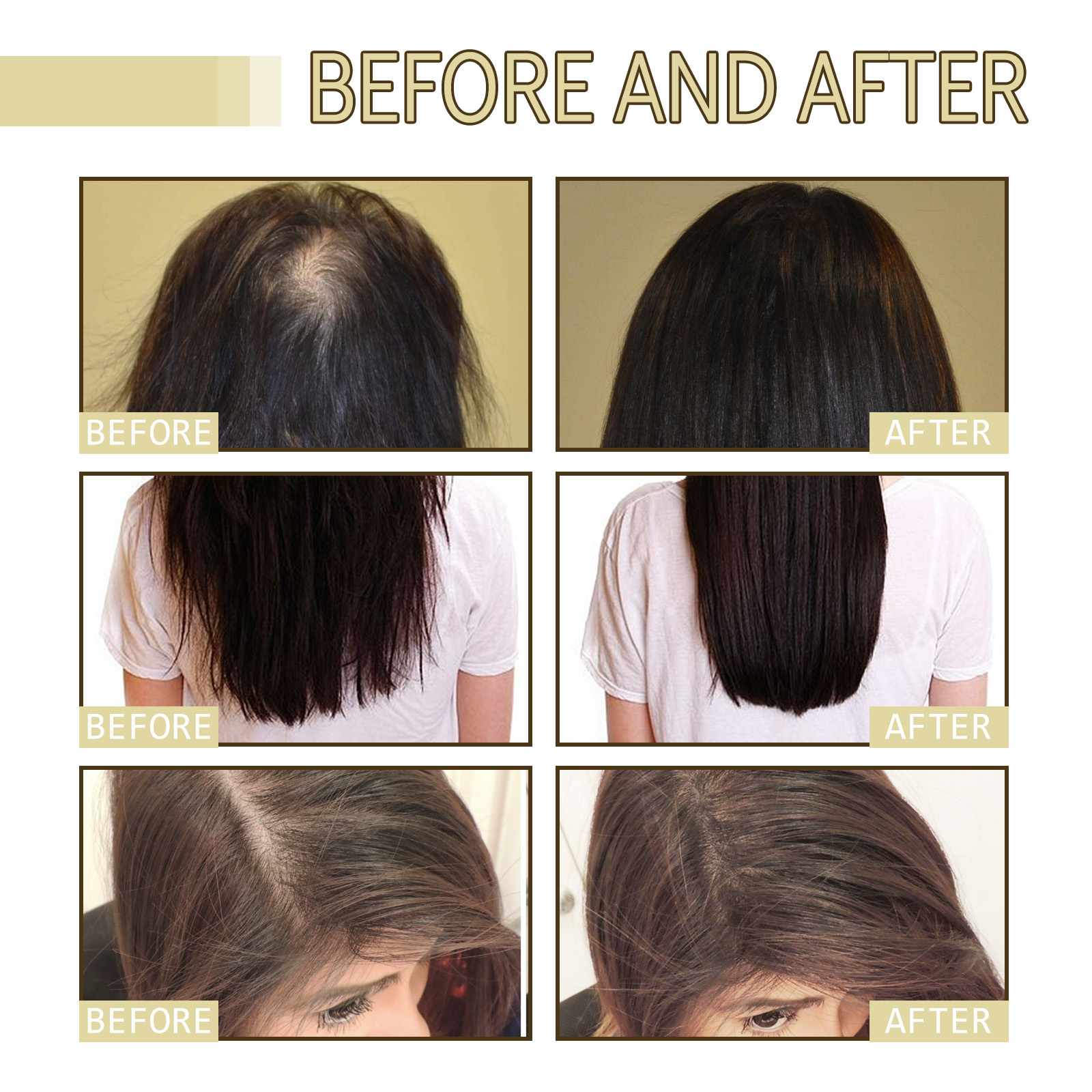 Rosemary Hair Growth Oil 60ml  - Hair Care For Hair Growth review and price