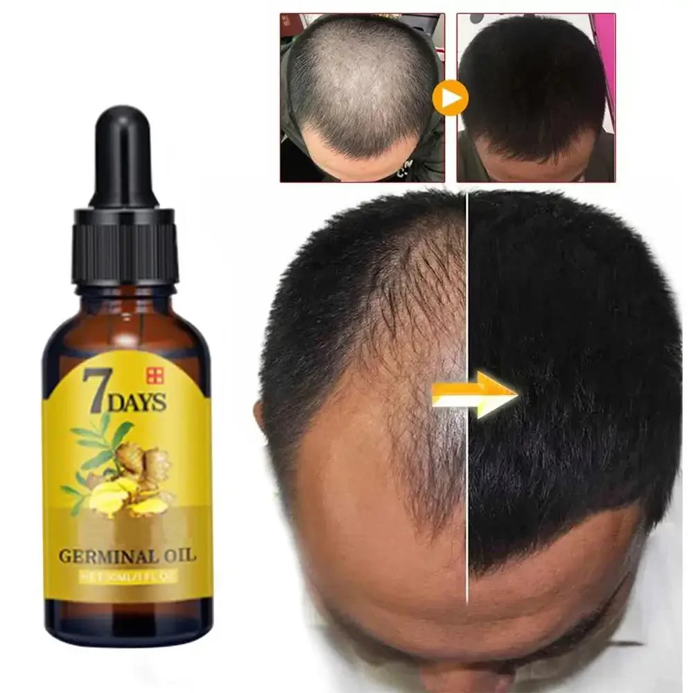 Hair Growth Ginger Fast Growin - Hair Care Essence Oil Spray review and price