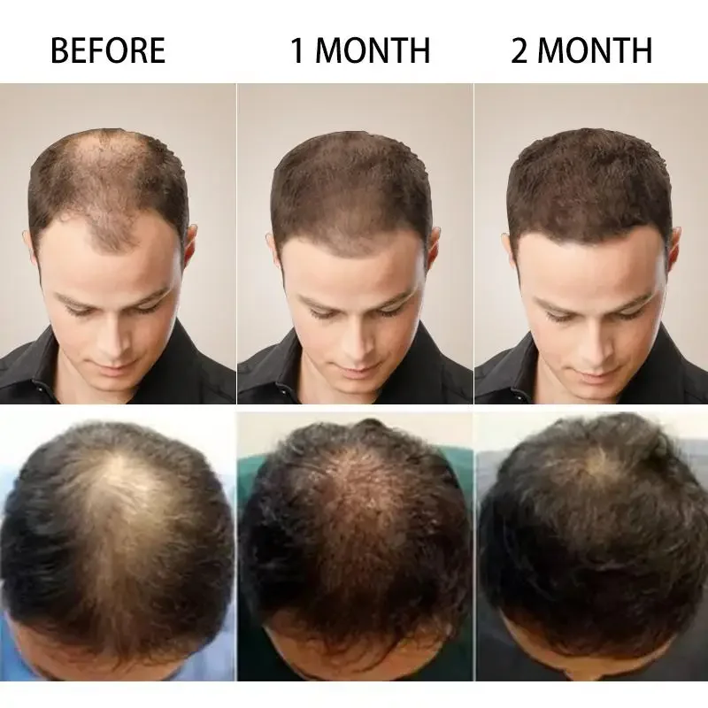 Hair Growth Ginger Fast Growin - Hair Care Essence Oil Spray review and price
