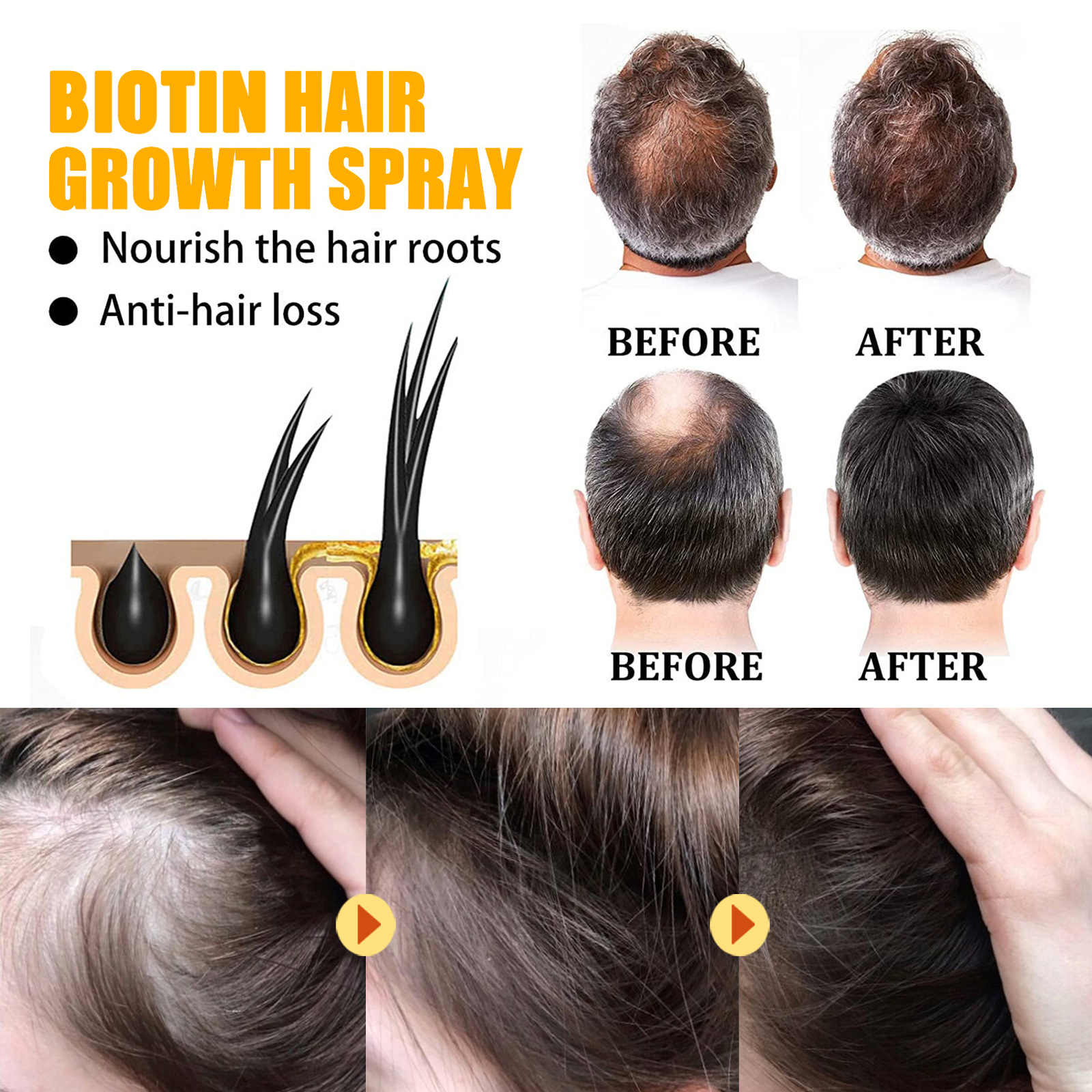 Biotin Hair Care Spray Nourish - Hair Care Essence Oil Spray review and price