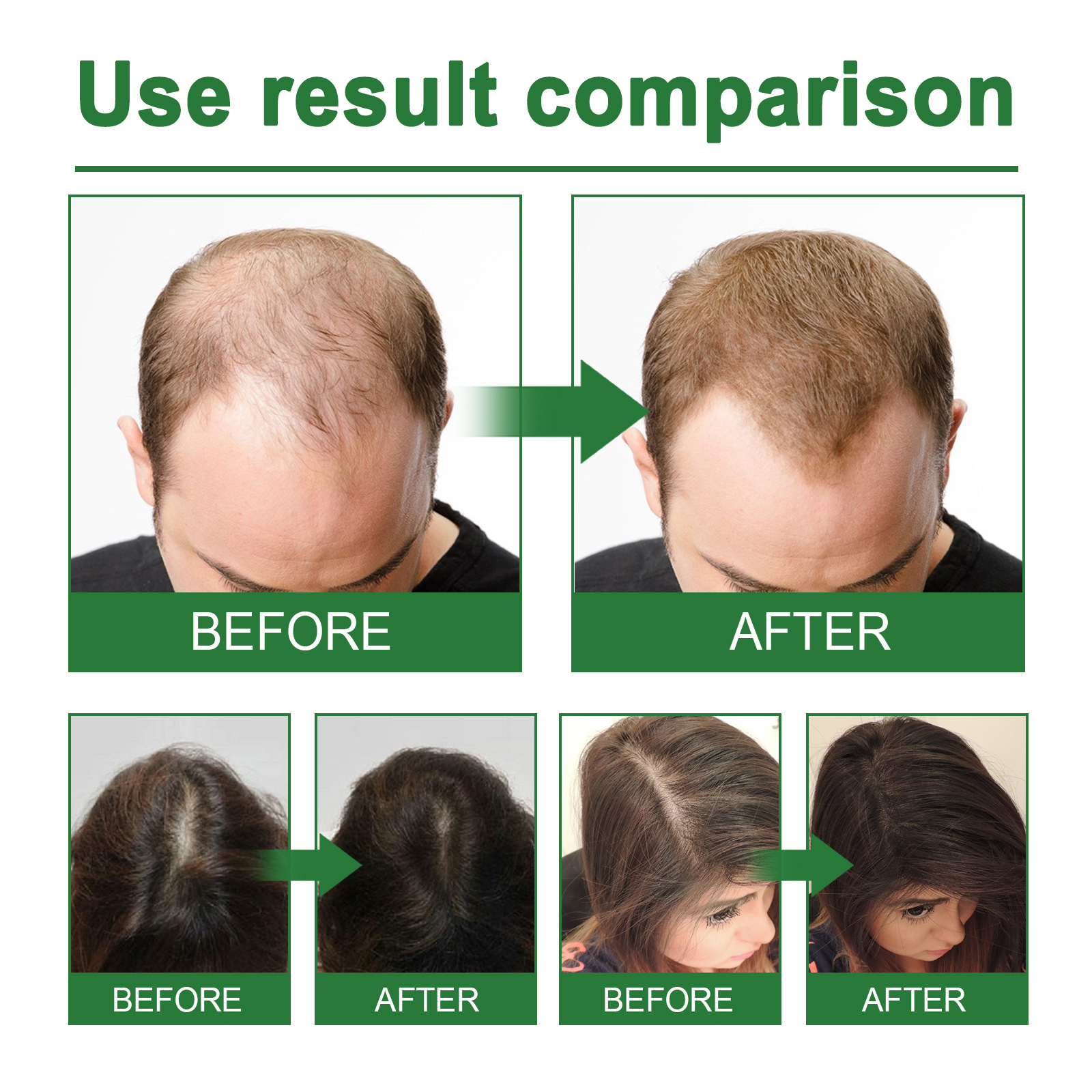 Rosemary Spray for Hair Nouris - Hair Care For Hair Growth review and price