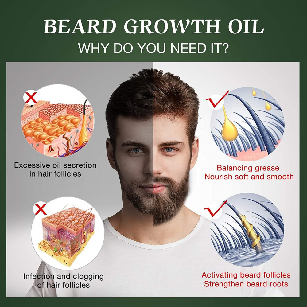 Fast Beard Growth Oil Beard Oi - Hair Care Essence Oil Spray review and price