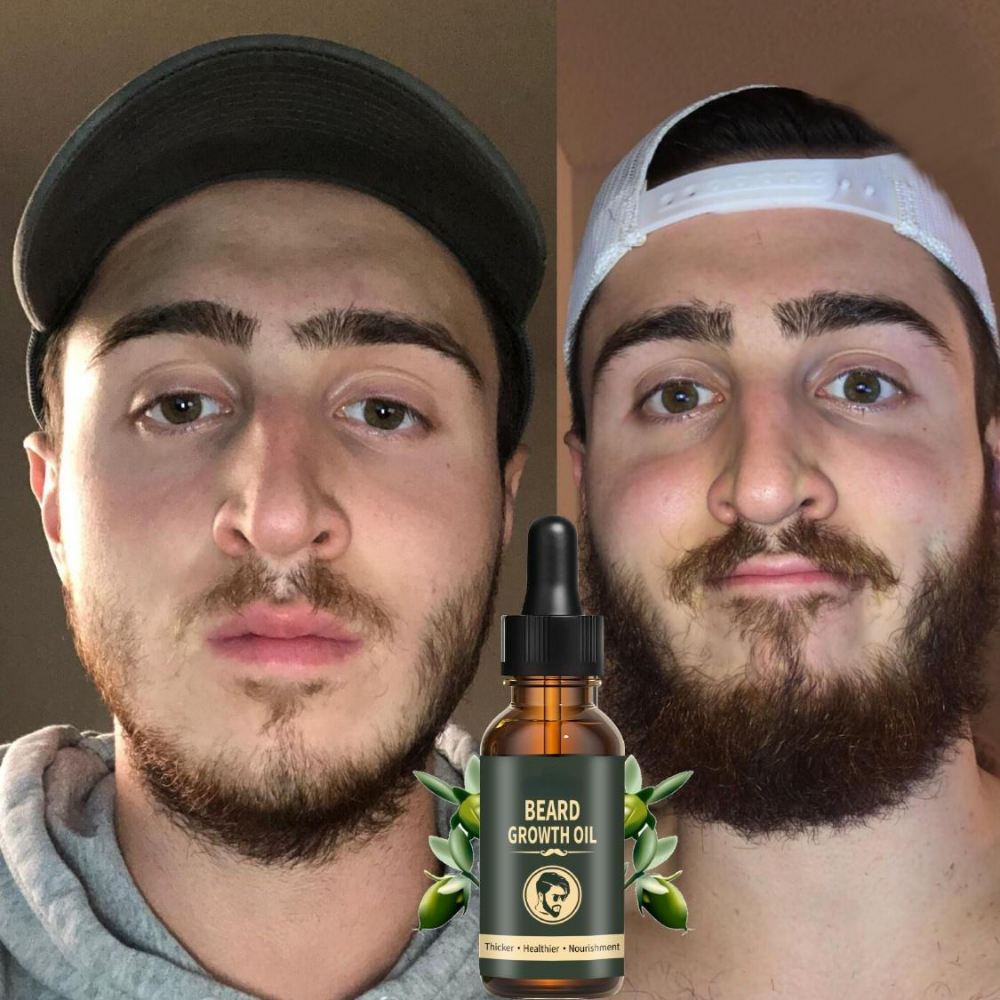Fast Beard Growth Oil Beard Oi - Hair Care Essence Oil Spray review and price