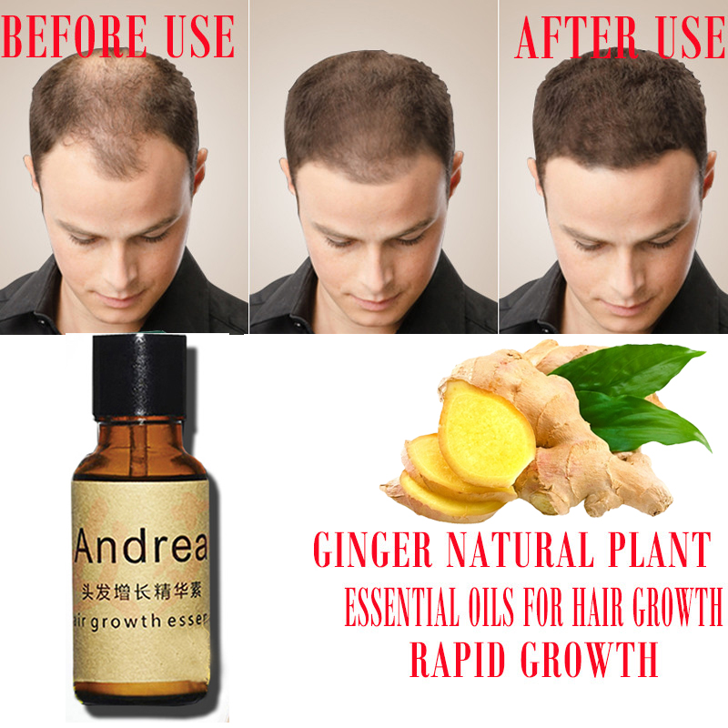 2/5/10Pcs Andrea Hair Growth S - Hair Care Essence Oil Spray review and price