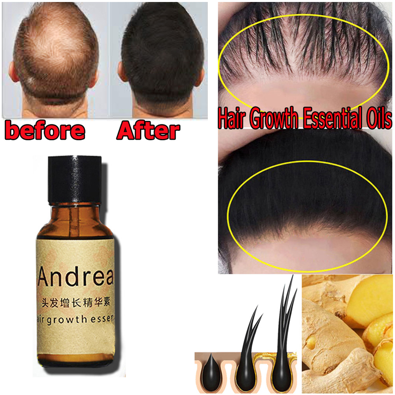 2/5/10Pcs Andrea Hair Growth S - Hair Care Essence Oil Spray review and price